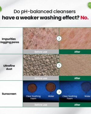 dr-g-global-cleansers-dr-g-ph-cleansing-r-e-d-blemish-clear-soothing-foam-150ml-1192435171